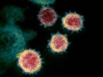 enhanced microscope image of the coronavirus