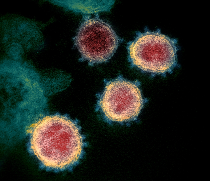 enhanced microscope image of the coronavirus